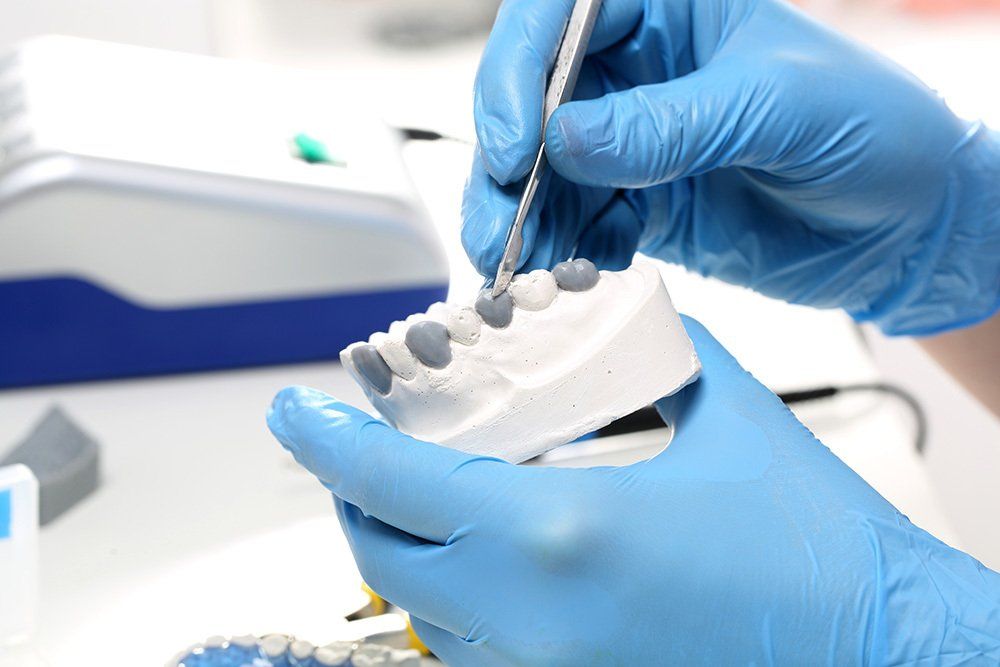 calco per dentiera e protesi mobili