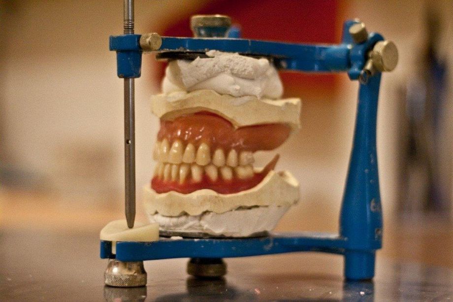 Impronta dentale