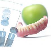 Astra Tech zobu implantācija