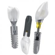 Astra Tech zobu implantu veidi