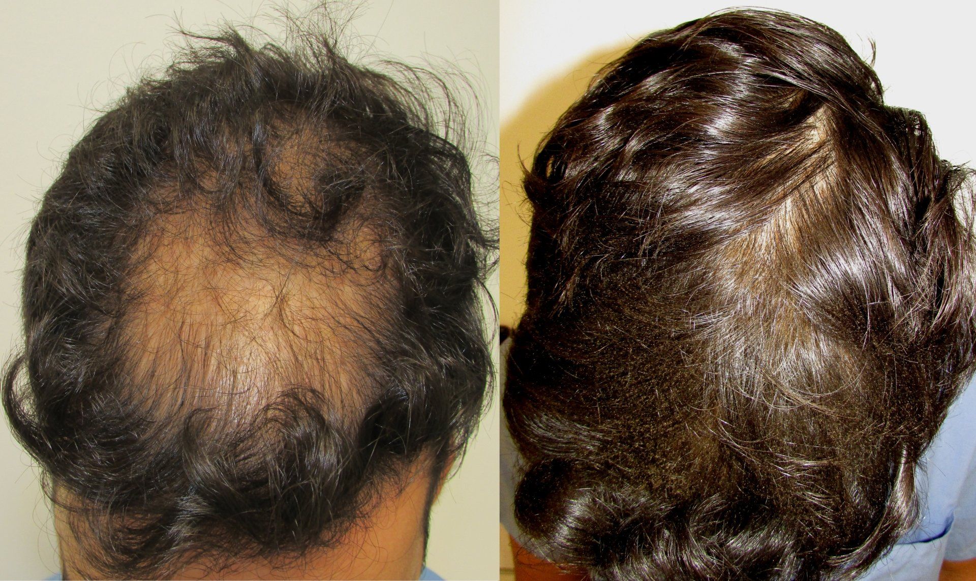 sam stop and regrowth hair regrowth review