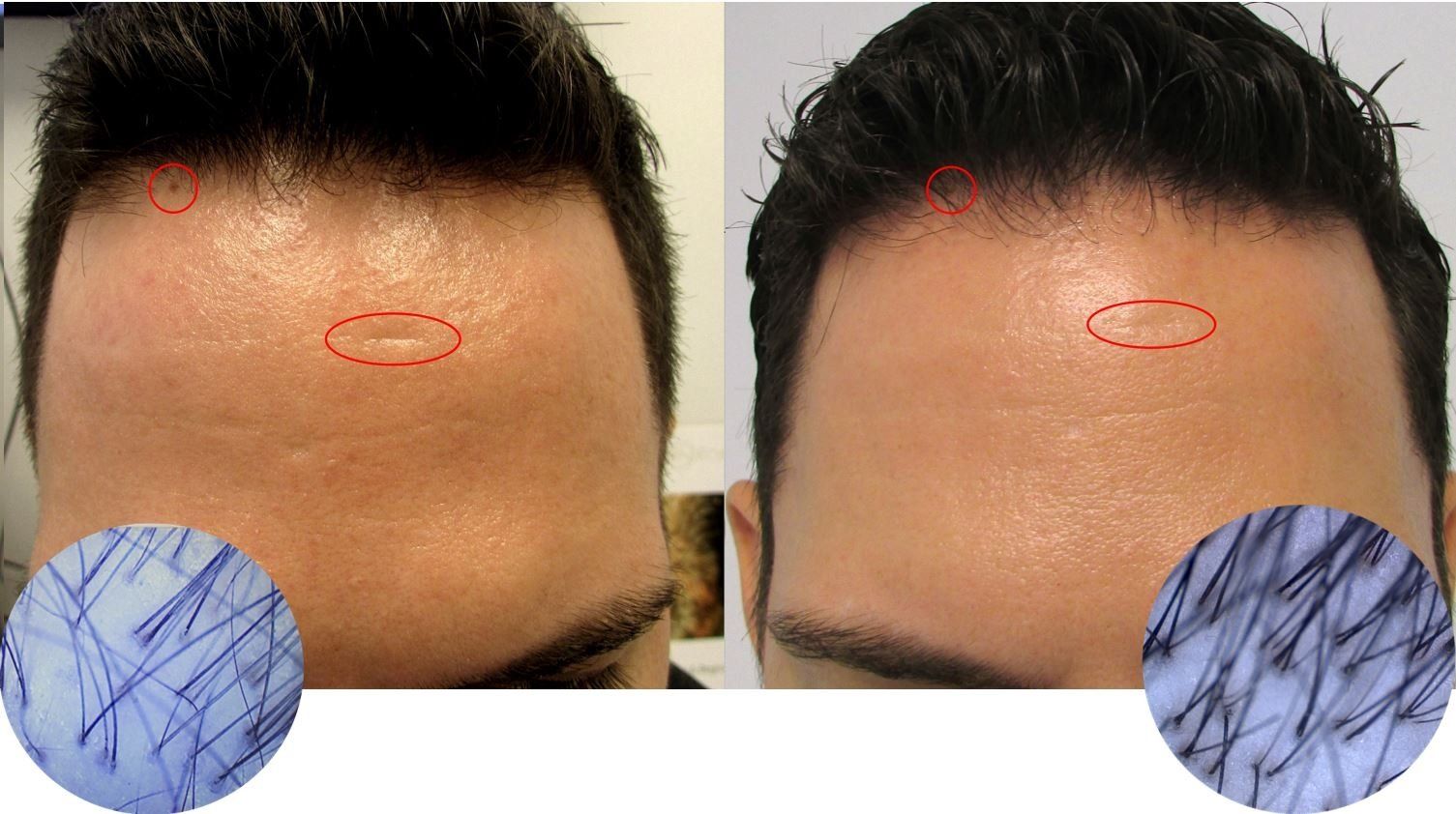 fantastic fast hair regrowth