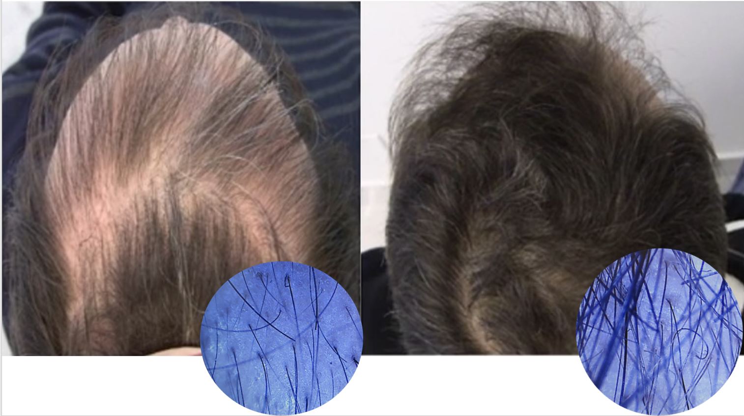 hair regrowth customer reviews