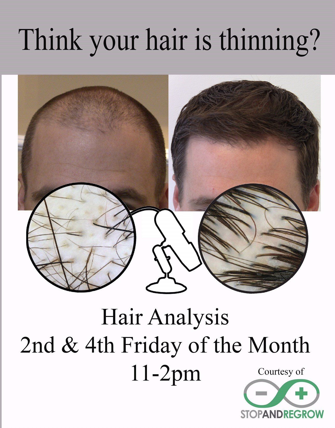 salon hair loss treatment