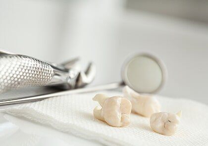 Extraction of Wisdom Tooth—Cosmetic Dentistry in Fillmore, CA Extraction of Wisdom Tooth—Cosmetic Dentistry in Fillmore, CA