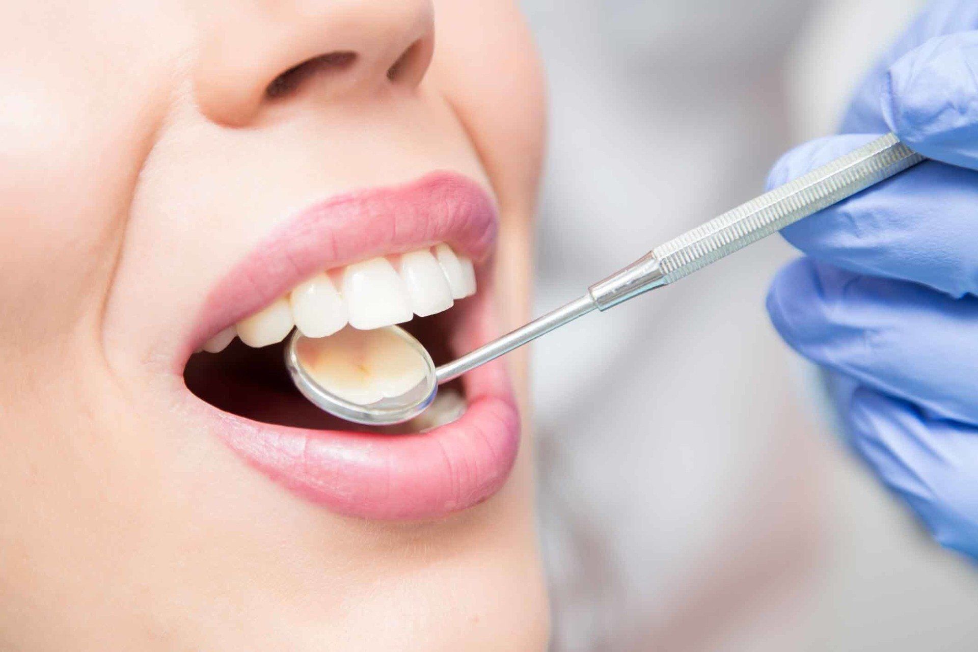 Dentist Checking Filling—Cosmetic Dentistry in Fillmore, CA Dentist Checking Filling—Cosmetic Dentistry in Fillmore, CA