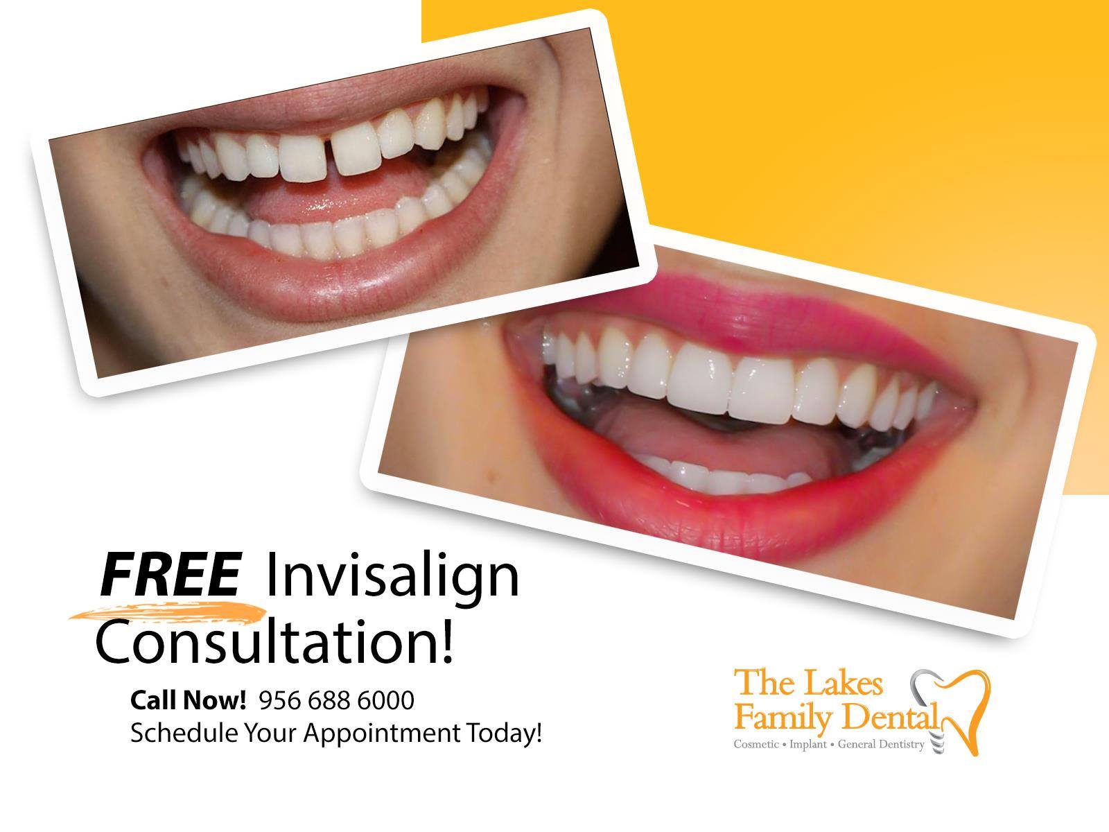 An advertisement for a free invisalign consultation at the lakes family dental
