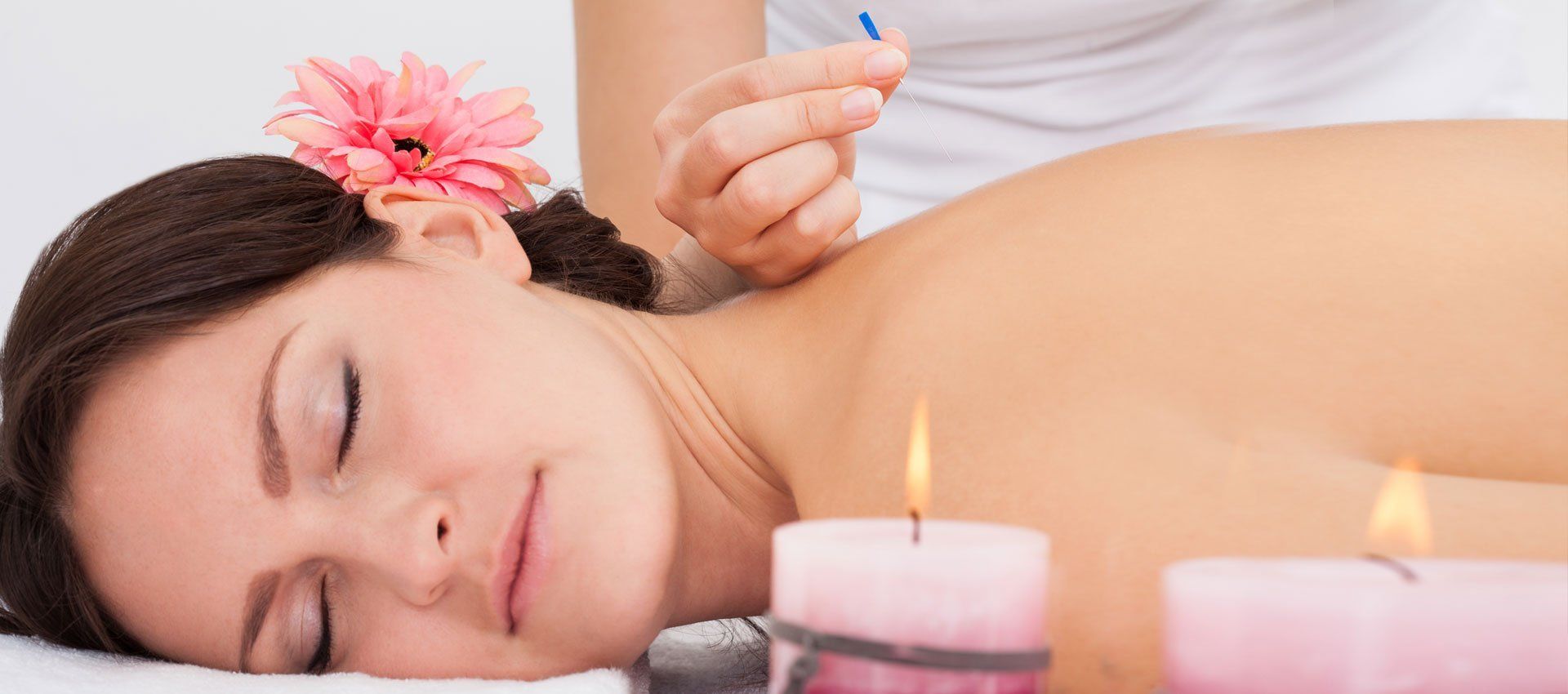 Acupuncture treatment