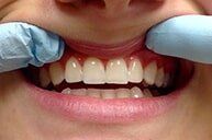 After 7 — Family dentists in Hampton, VA After 7 — Family dentists in Hampton, VA