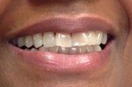 After 8 — Family dentists in Hampton, VA After 8 — Family dentists in Hampton, VA