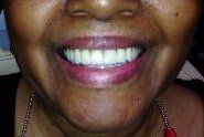 After 4 — Family dentists in Hampton, VA After 4 — Family dentists in Hampton, VA