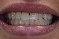 After 5 — Family dentists in Hampton, VA After 5 — Family dentists in Hampton, VA
