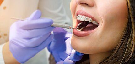 Woman Having Dental Check Up — Orthodontics in Deerfield Beach, FL Woman Having Dental Check Up — Orthodontics in Deerfield Beach, FL