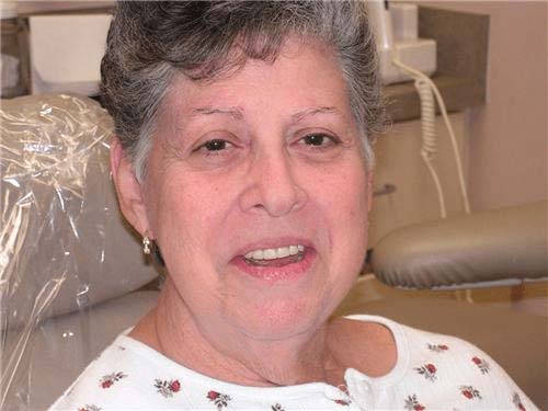 happy patient full over full dentures .Chris Castellano DMD , top implant dentist , Riverview, Fl. 33578