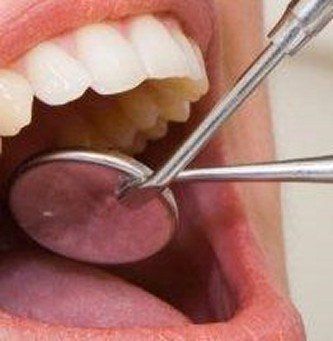 the dental exam! Chris Castellano DMD , top implant dentist , Riverview, Fl. 33578