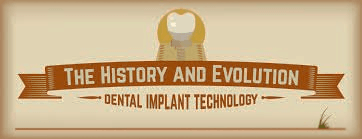 History of dental implants, Chris Castellano DMD, best dentist near me, 33578, Riverview, Fl.  