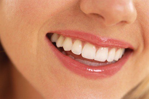 pretty smile! Chris Castellano DMD , top cosmetic dentist , Riverview, Fl. 33578