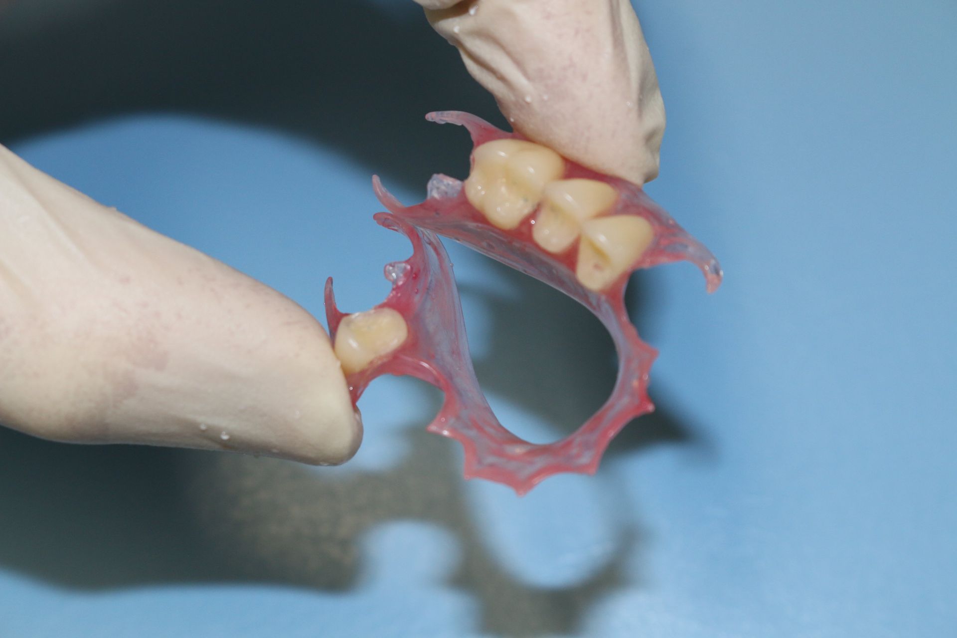 DENTURE REPAIRS gold coast