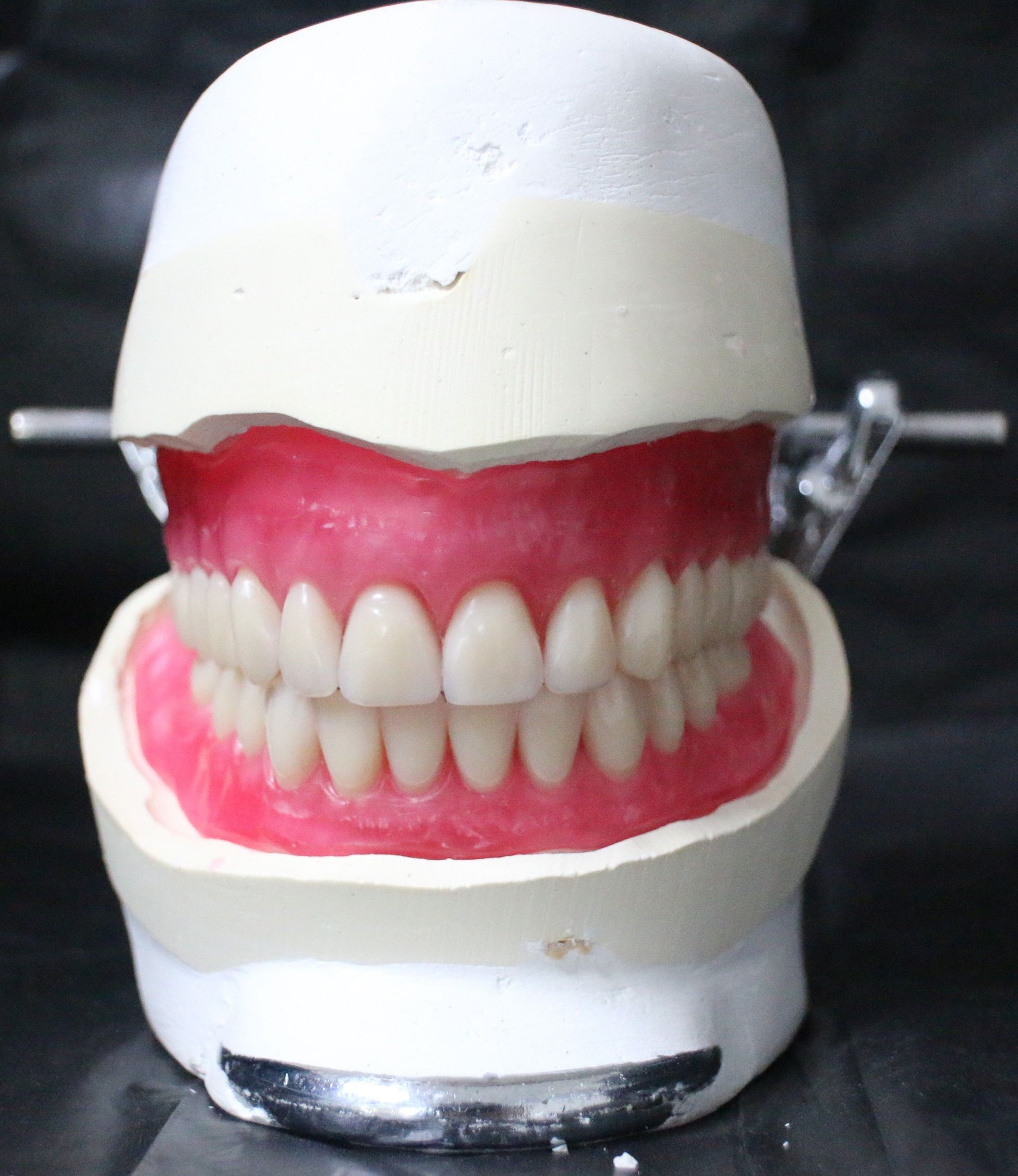 DENTURE REPAIRS
