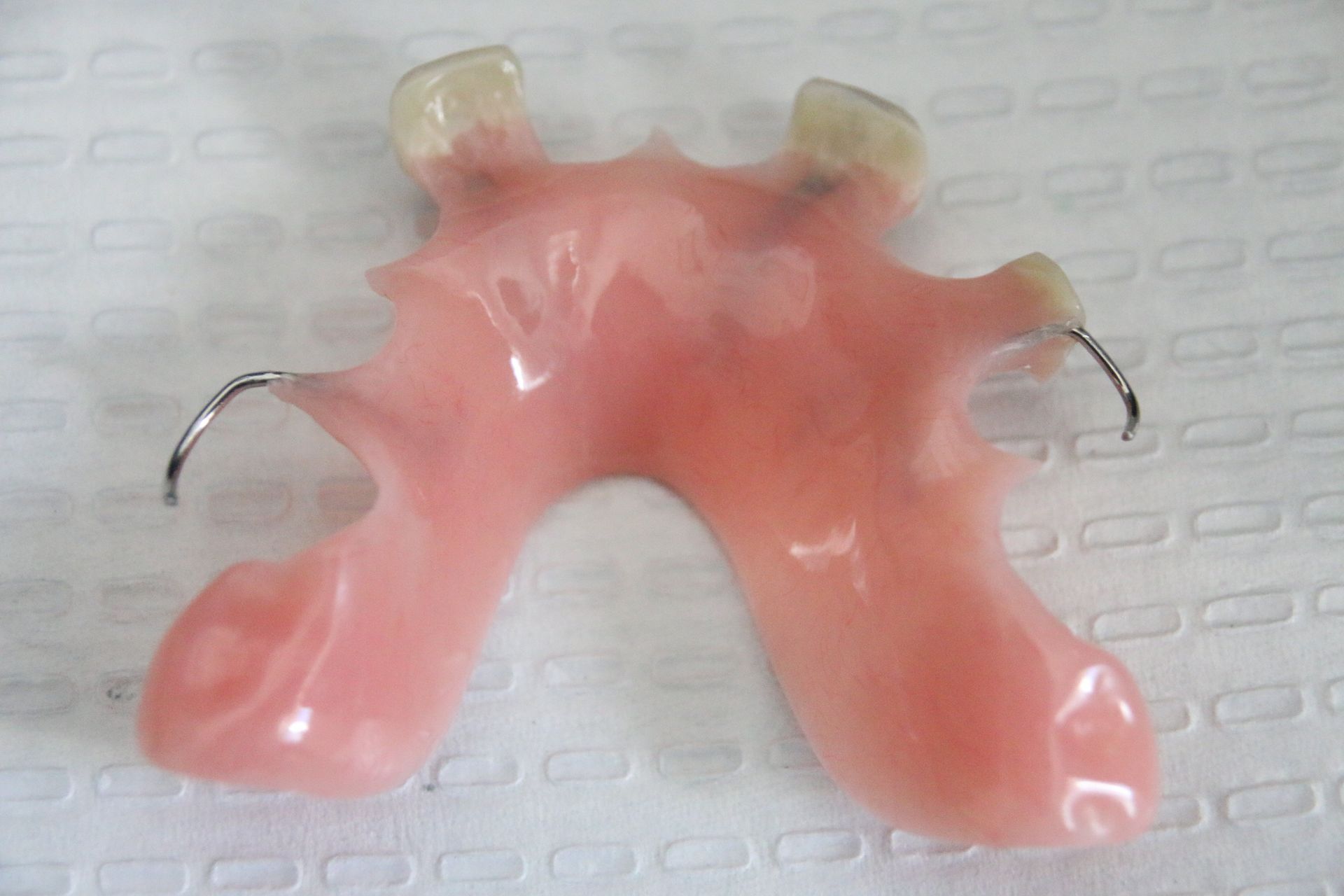 Full Upper Denture With Chrome Palate services