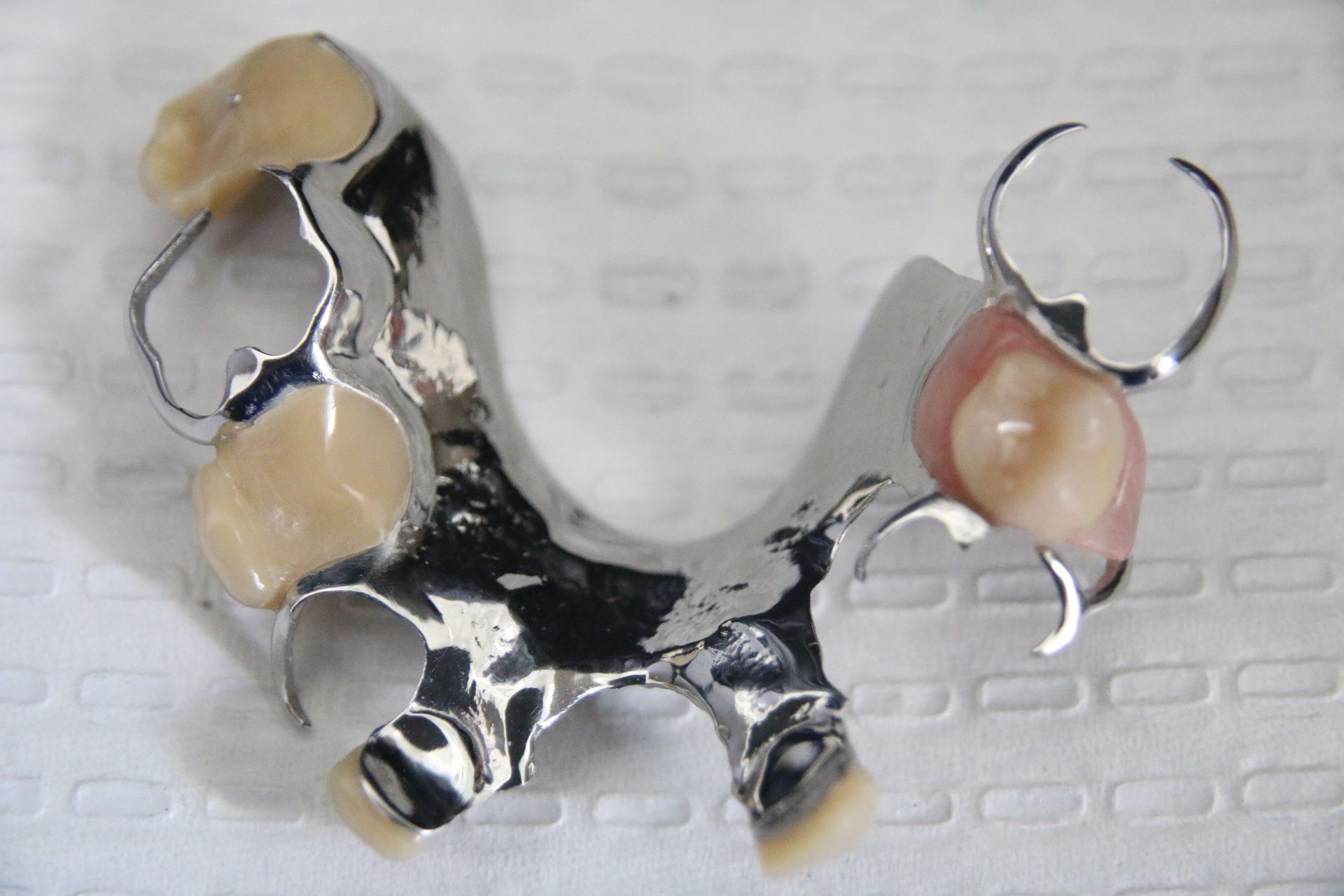 Partial Chrome Denture gold coast
