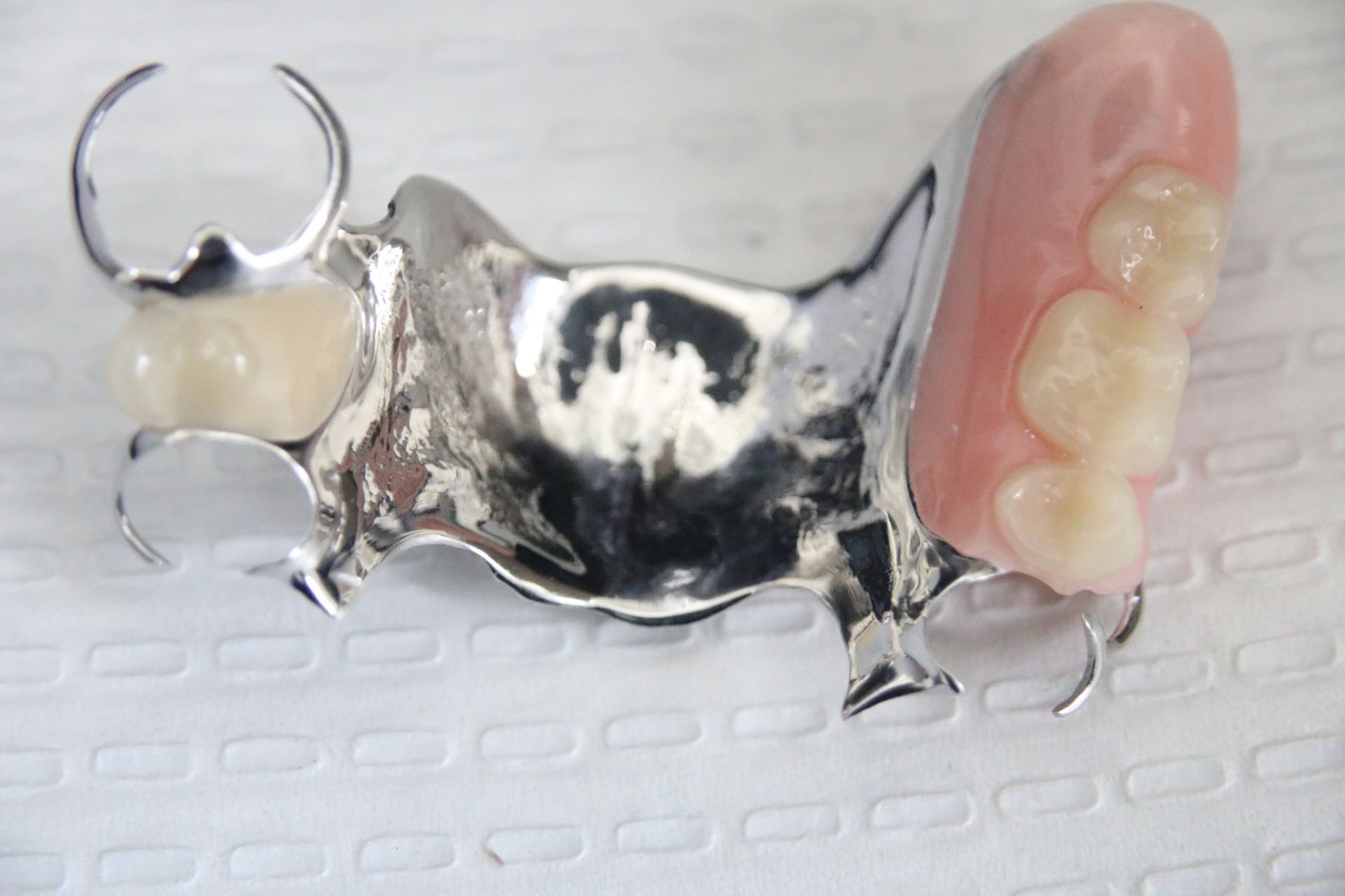 Partial Chrome Denture