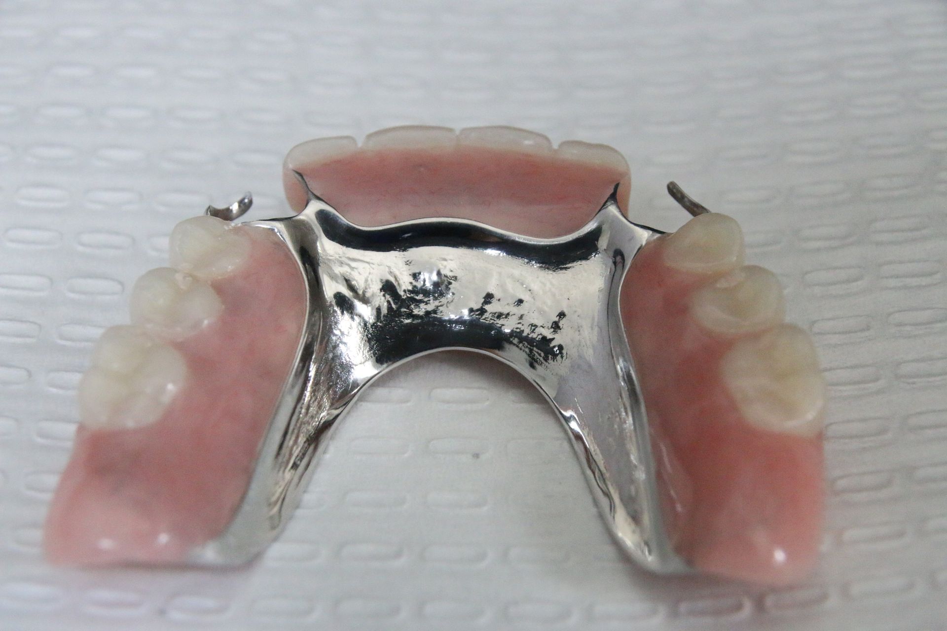 Partial Chrome Denture in gold coast