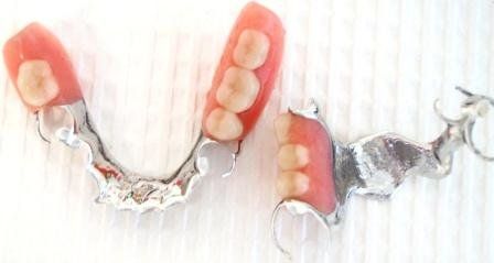 Partial Upper & Lower Chromes