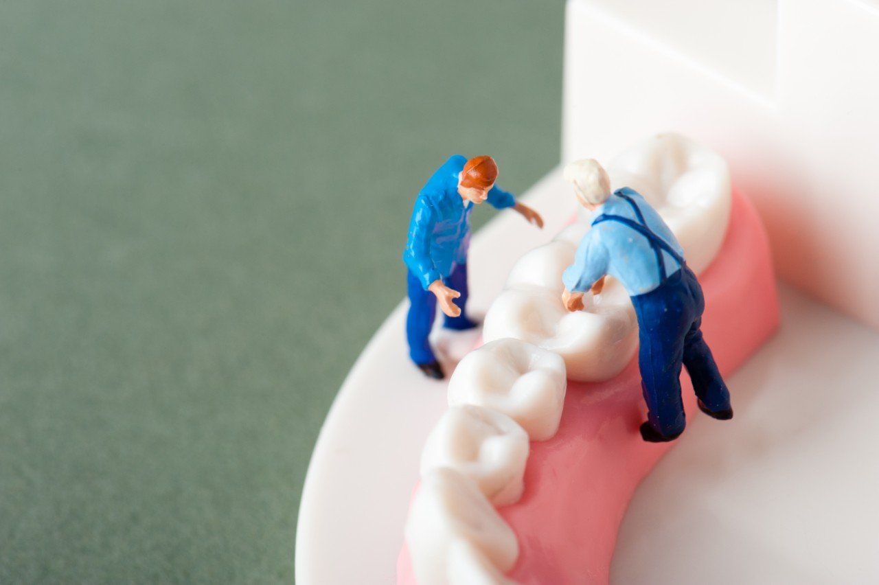 Two miniature men are working on a model of teeth.