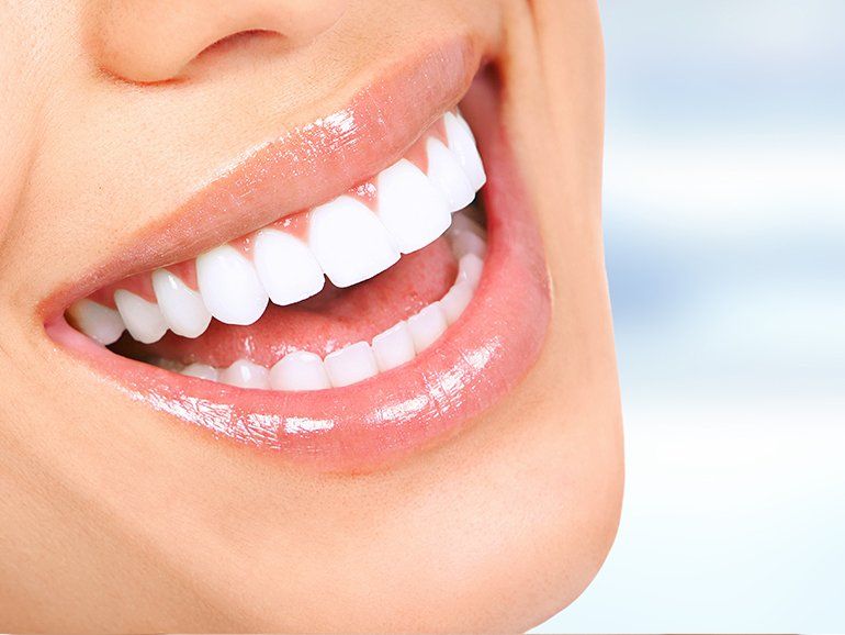 Oral Hygiene