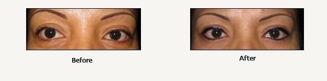 Eye lines before and after — Makeup Salon in Appleton, WI Eye lines before and after — Makeup Salon in Appleton, WI