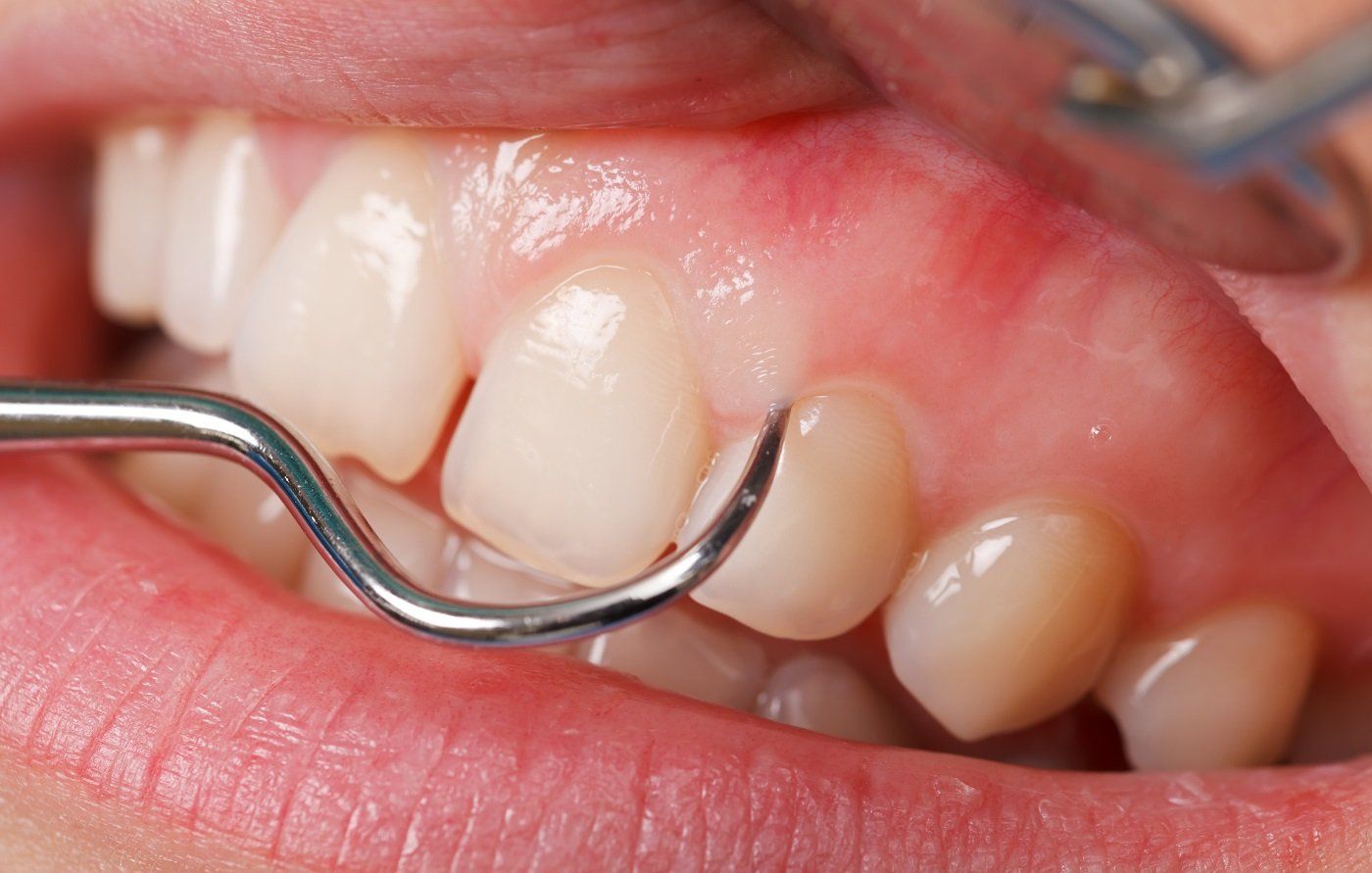 Teeth being worked on