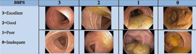 Gastrointestinal — Human Internal Organs in Tallahassee, FL