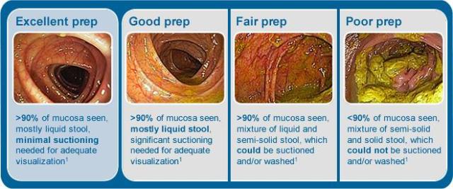 Stomach Problems — Endoscopy Assessment in Tallahassee, FL