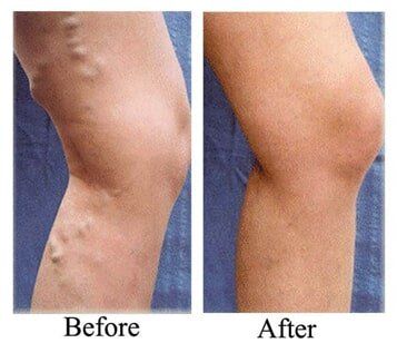 Aesthetic & Wellness in Placentia, CA Aesthetic & Wellness in Placentia, CA