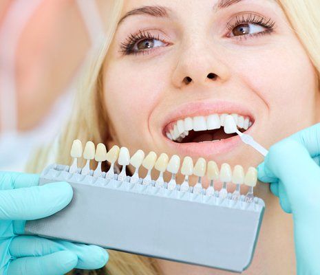 Veneers — Closeup of a Girl Smiling at the Dentist in Brownsburg, IN Veneers — Closeup of a Girl Smiling at the Dentist in Brownsburg, IN