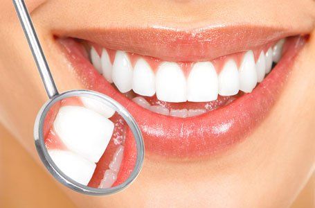 Porcelain veneers