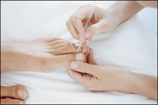 Toenail care