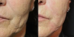 ESTETICA DENTALE