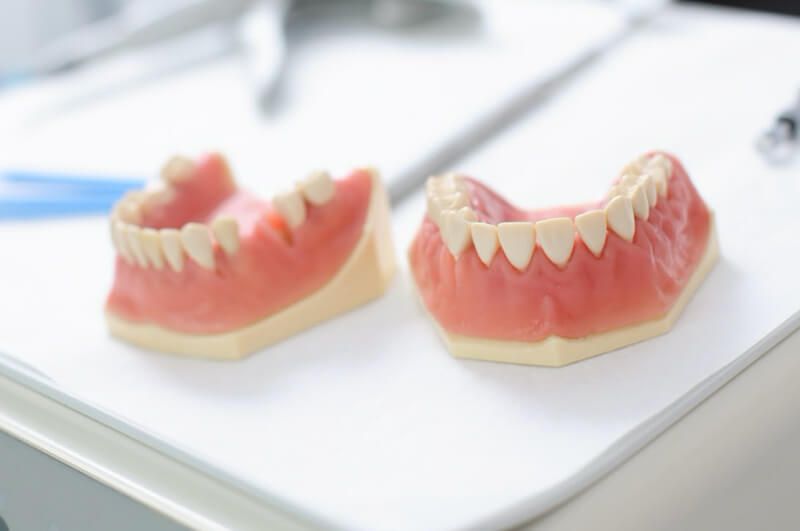 Teeth and Gums Model — Pittsburgh, PA — Pittsburgh Dental Spa Teeth and Gums Model — Pittsburgh, PA — Pittsburgh Dental Spa
