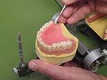 New Denture being Made — Dentures in Yakima, WA New Denture being Made — Dentures in Yakima, WA
