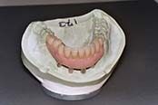 Denture in Mold — Dentures in Yakima, WA Denture in Mold — Dentures in Yakima, WA