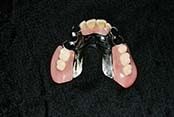 Special Made Dentures — Dentures in Yakima, WA Special Made Dentures — Dentures in Yakima, WA