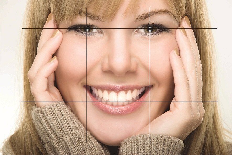 Diseño de Sonrisa y estética dental en cali