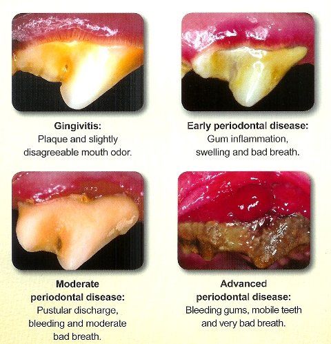 dental grading