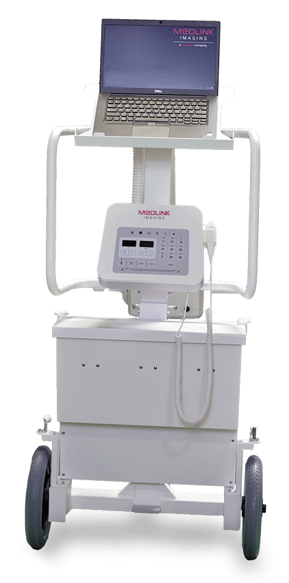 A portable X-ray machine on wheels, white with a laptop on top.