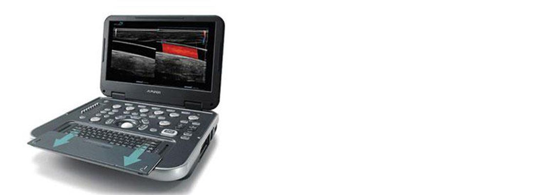 A handheld ultrasound machine, displaying an image on its screen.