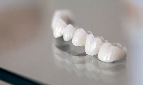 Zirconium Porcelain Tooth — Washington, PA — Snee Dental Associates Zirconium Porcelain Tooth — Washington, PA — Snee Dental Associates