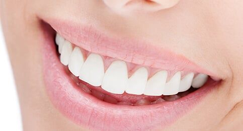 Woman with White Teeth - Dentists in Washington, PA Woman with White Teeth - Dentists in Washington, PA