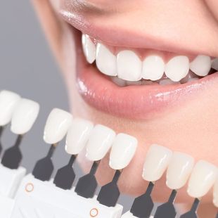 teeth whitening
